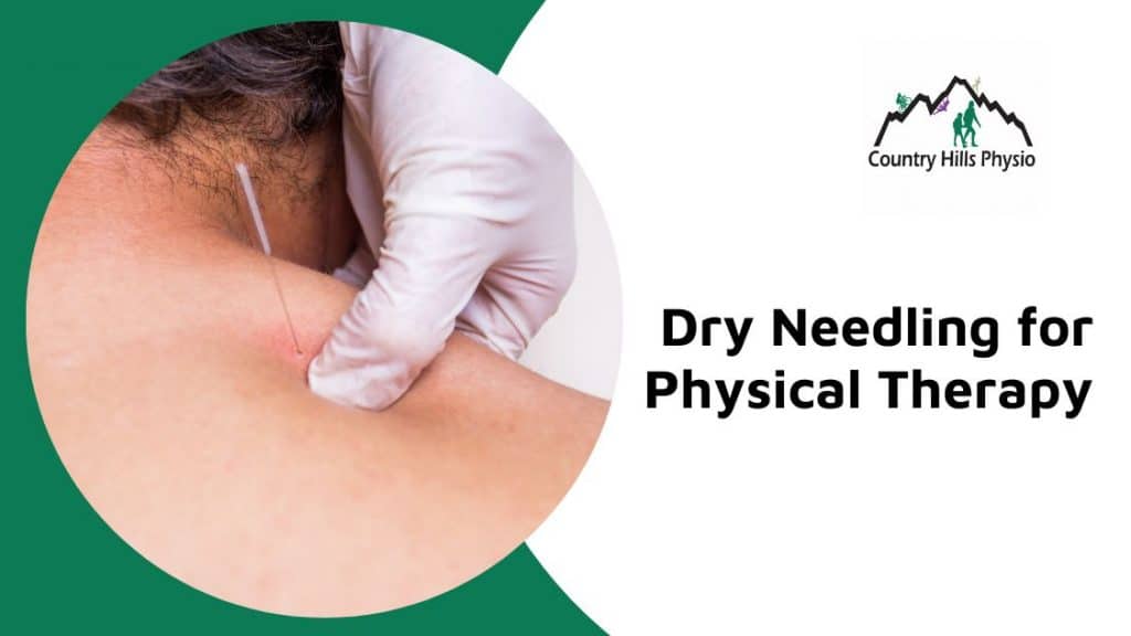 Dry needling for physical therapy Calgary NW