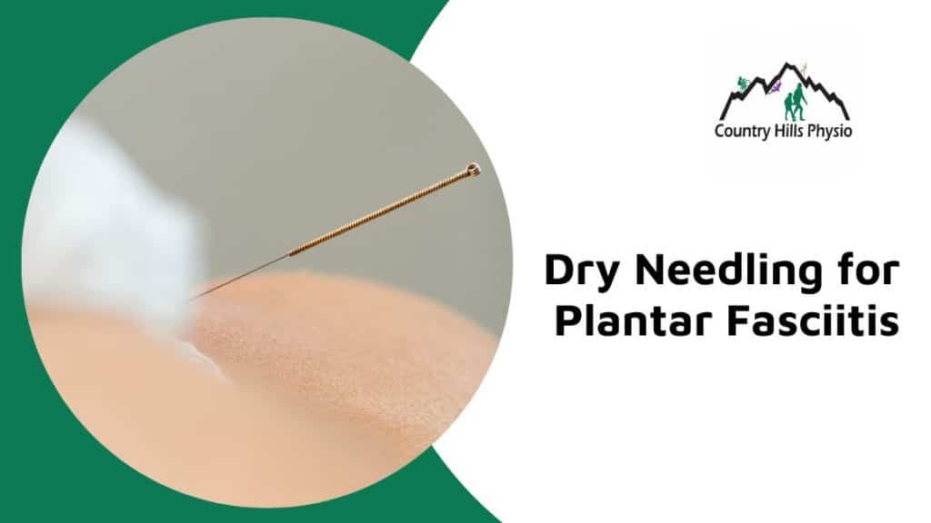 dry needling for plantar fasciitis calgary nw